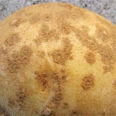 Schorf an Kartoffeln