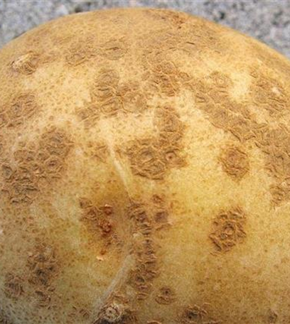 Schorf an Kartoffeln